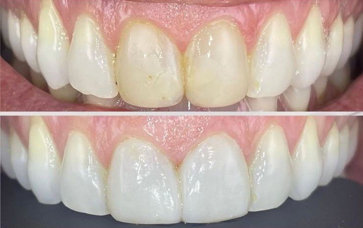 Case 03